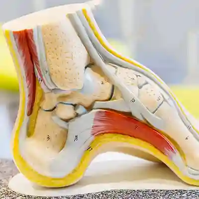 Arch Pain Treatment and Plantar Fasciitis relief in Irvine CA