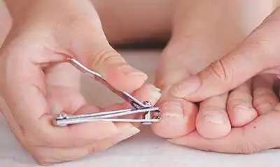 When to see an Irvine podiatrist for ingrown toenails